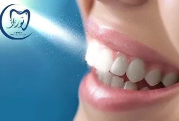 بهترین متخصص کامپوزیت کرج