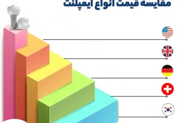 هزینه ایمپلت دندان در کرج