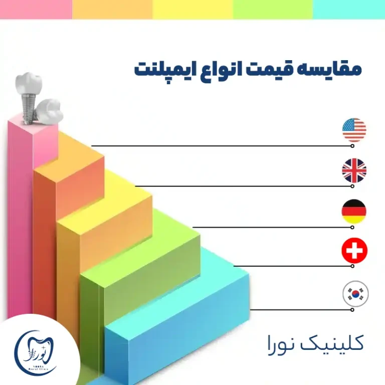 هزینه ایمپلت دندان در کرج