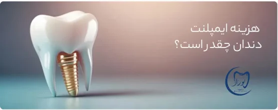 هزینه ایمپلنت دندان در کرج
