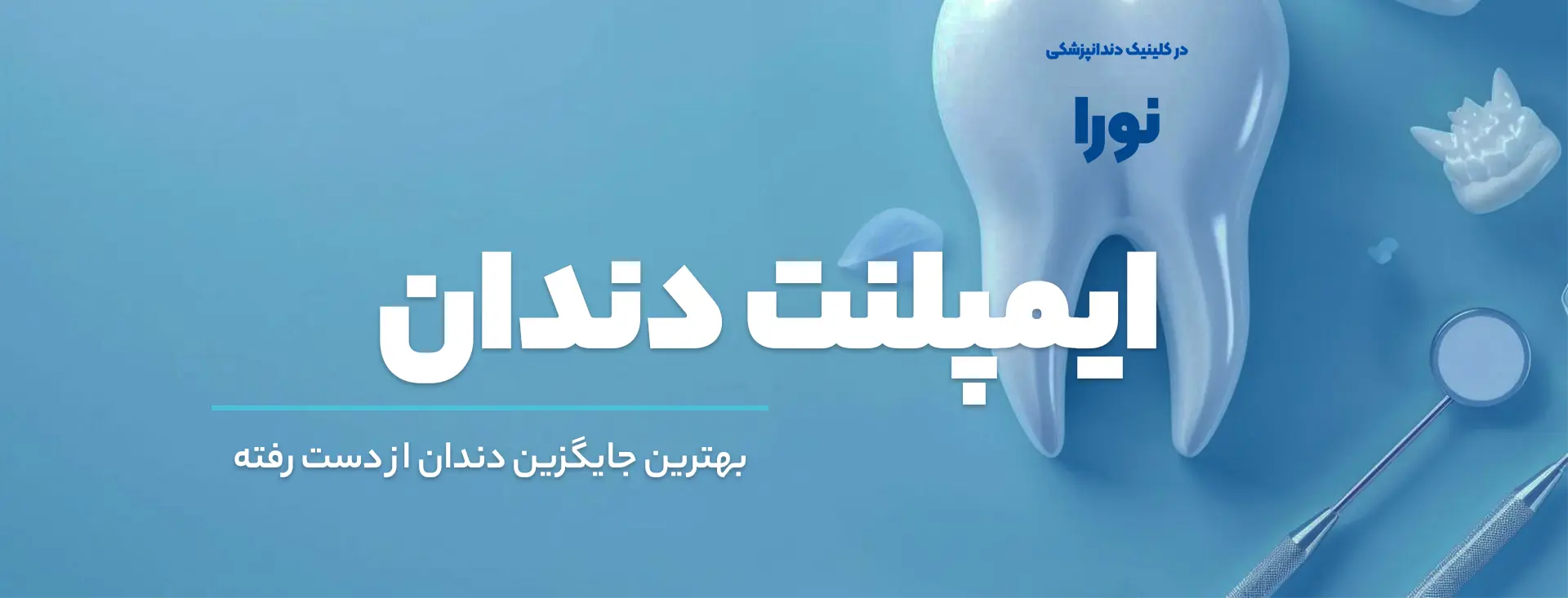 ایمپلنت در کرج - ایمپلنت دندان