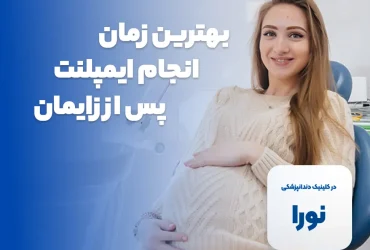 ایمپلنت در بارداری - متخصص ایمپلنت کرج
