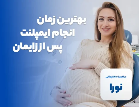 ایمپلنت در بارداری - متخصص ایمپلنت کرج
